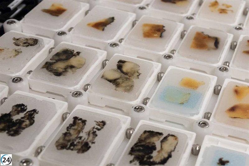 El Hospital Clínic optimiza resultados en biopsias con tecnología robótica
